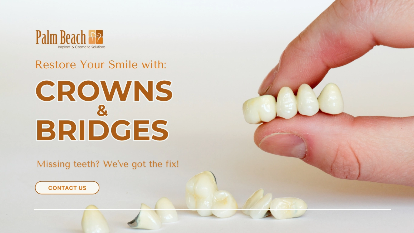 Best Smile-Crowns & Bridges