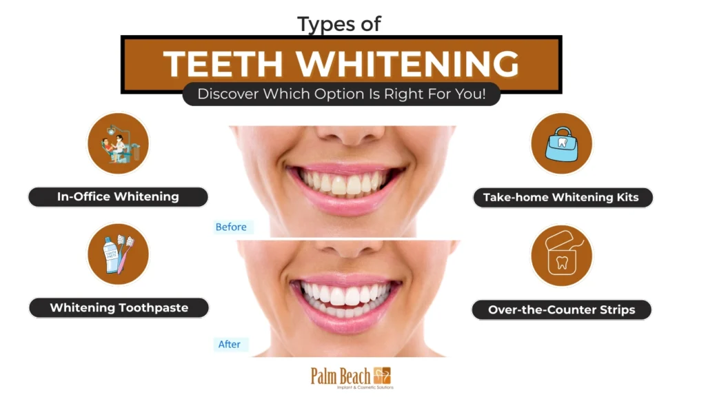 Palm beach-Types of teeth