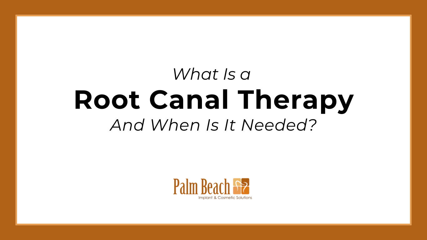 Root Canal Therapy: What You Need to Know